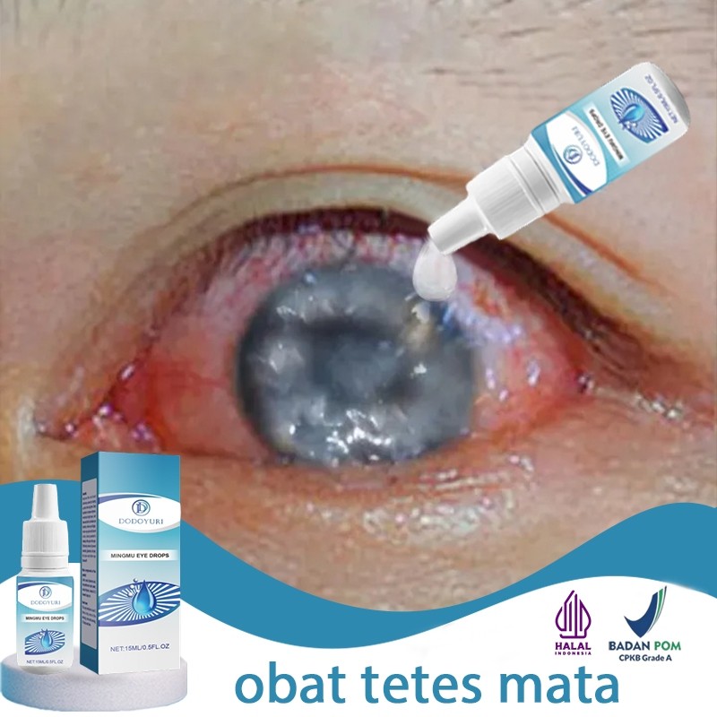 Obat mata katarak obat mata minus obat tetes mata pembersih mata 15ml Tetes mata softlens obat mata