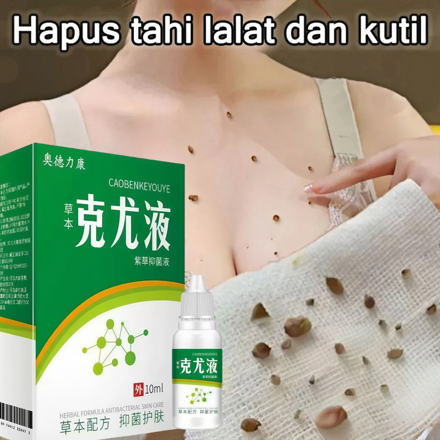 Obat kutil paling ampuh salep kutil obat kutil di leher penghilang kutil dan tahi lalat 10ml obat