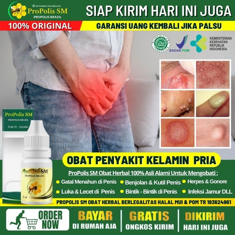 Obat Balanitis 100% Alami - Obat Gatal di Kepala Penis, Kepala Penis Lecet, Kulup Penis Gatal Gatel