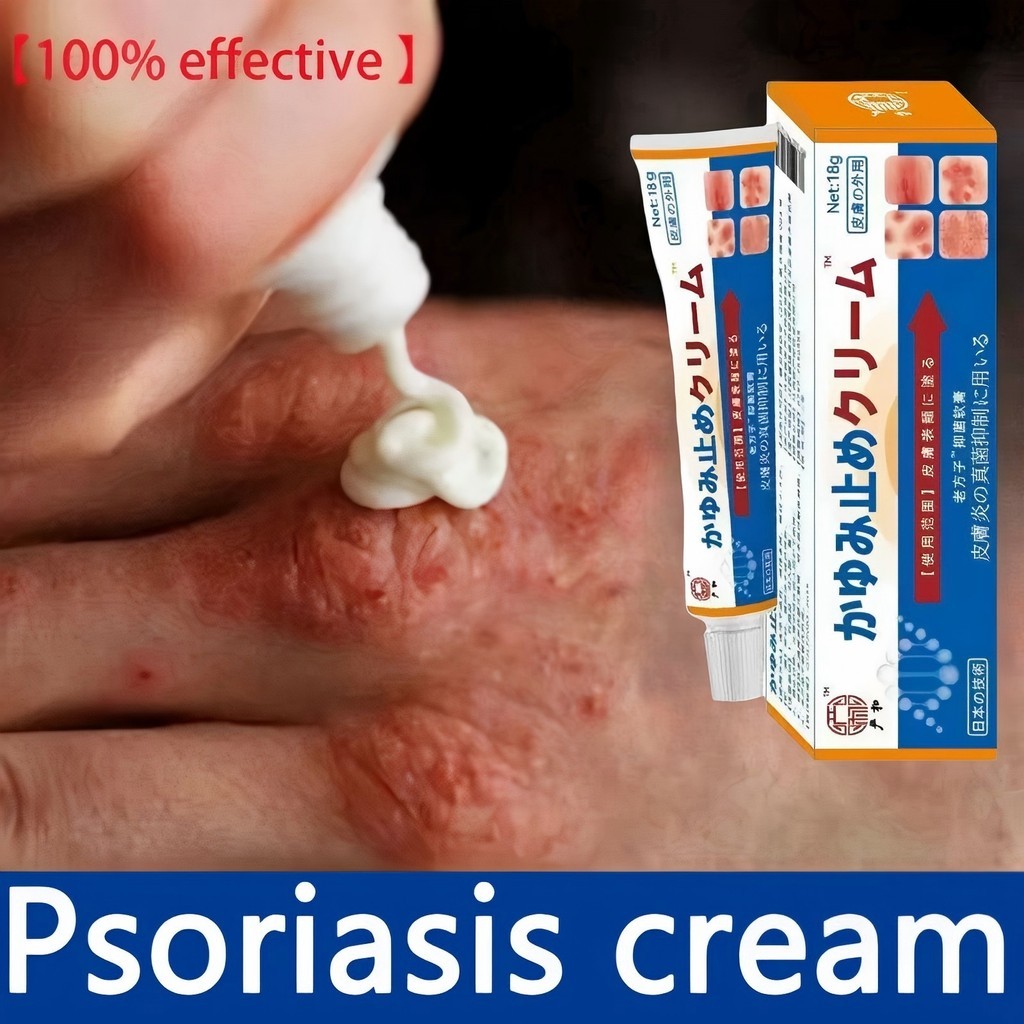 herbal Cina khusus untuk psoriasis membandel, psoriasis, jock itch, salep psoriasissalep gatal kulit