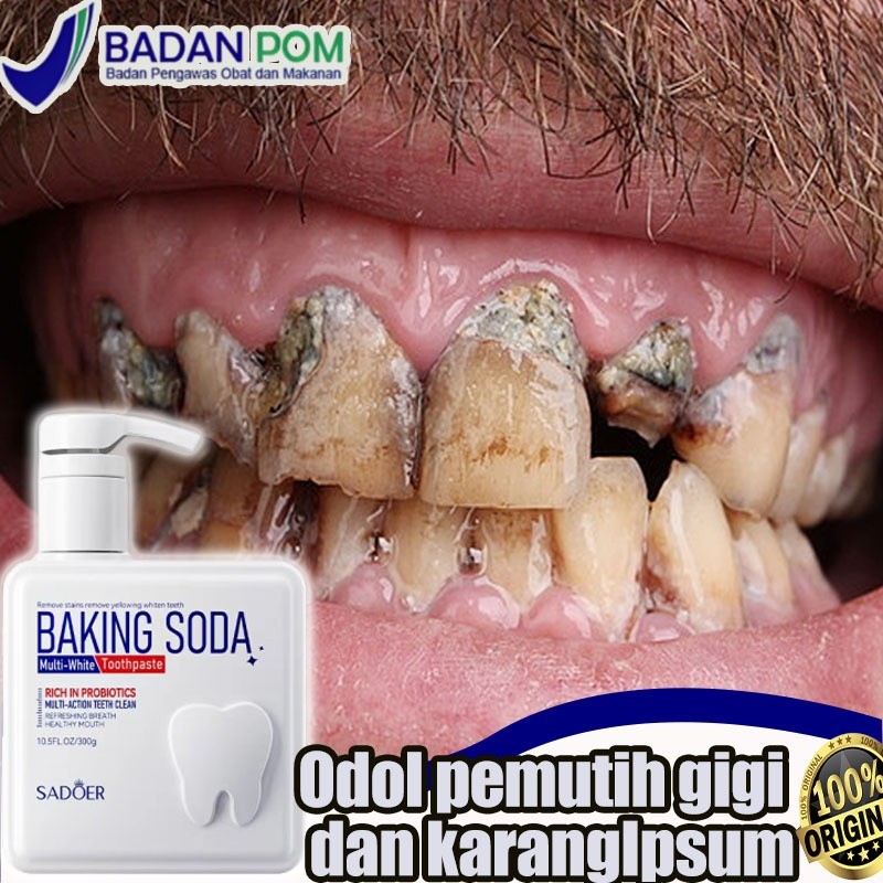 Odol pemutih gigi dan karang gigi Pembersih karang gigi Pembersih gigi kuning dan karang Perontok