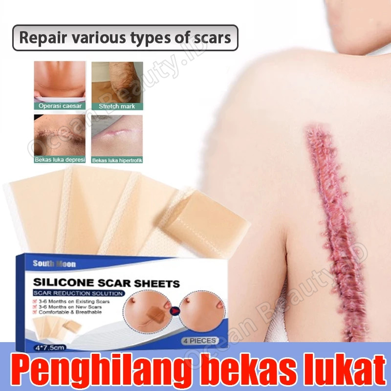 Silicone Scar Sheet Plester Bekas Luka Keloid Plester Silikon Penghilang Bekas Luka Plester Keloid