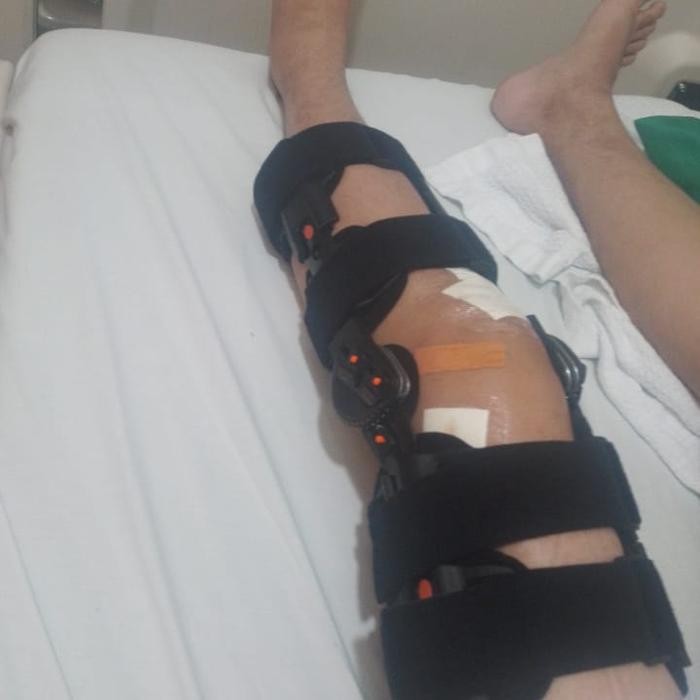 Knee Brace Post Op ACL