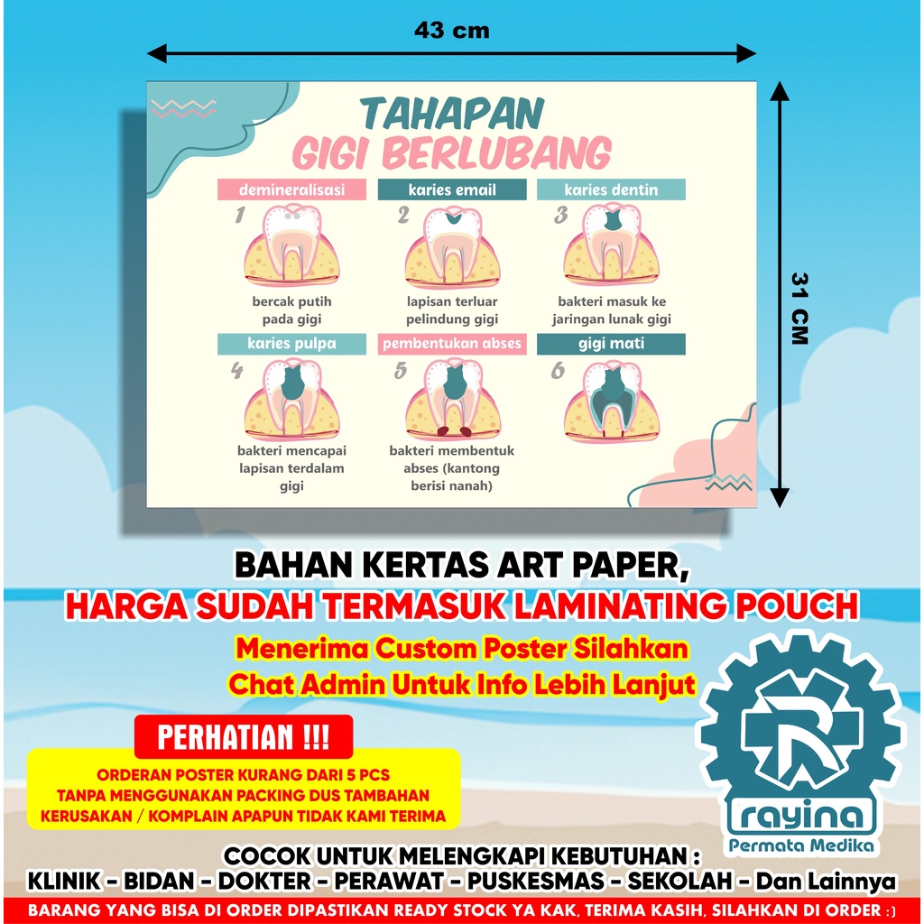 Poster Kesehatan Tahapan Gigi Berlubang