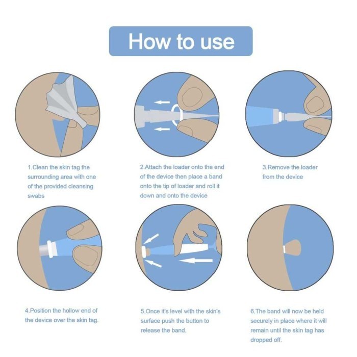 Ready- Kutilat Remover Original Mbp