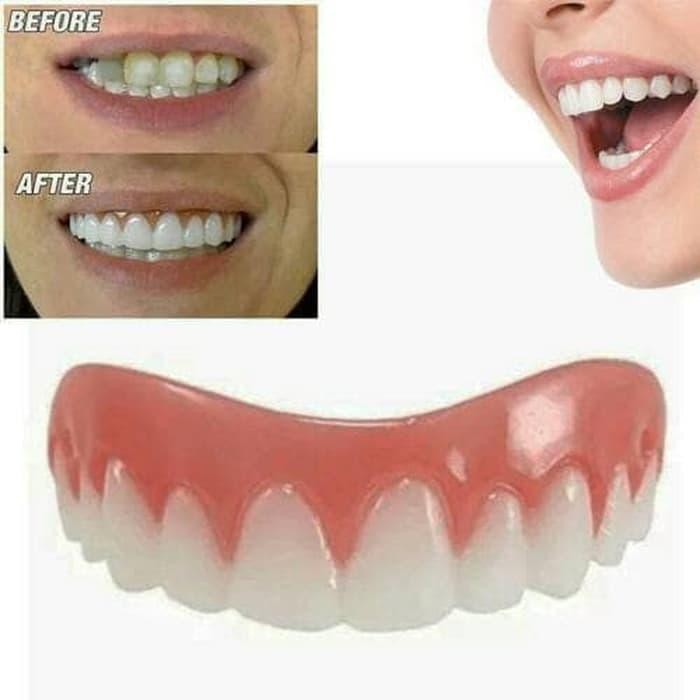 Gigi Palsu Instan Perfect Smile Veneer, Gigi Tiruan Bagian Atas