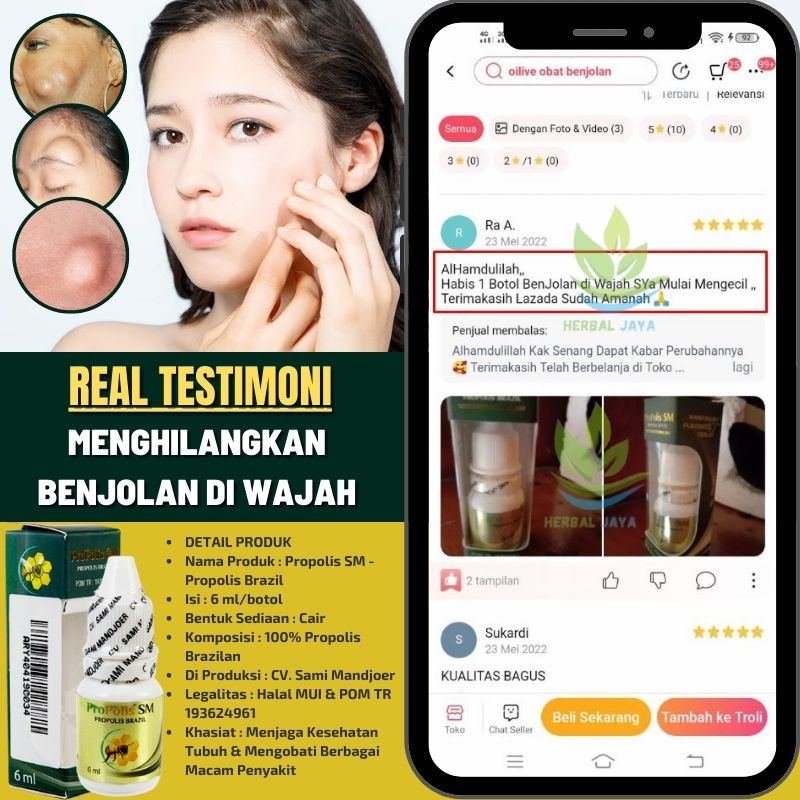 Obat Melenyapkan Benjolan di Wajah, Pengempis Benjolan Lemak Lipoma di Wajah, Obat Benjolan di Wajah