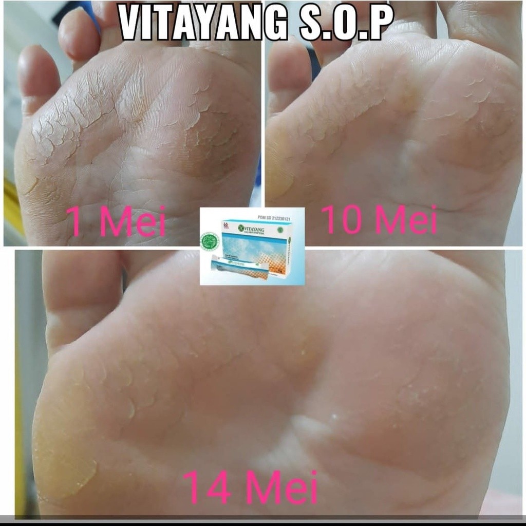 SOP Salmon Ovary Peptide Enak Rasa Jeruk dan Sehat Cantik Alami KK Indonesia
