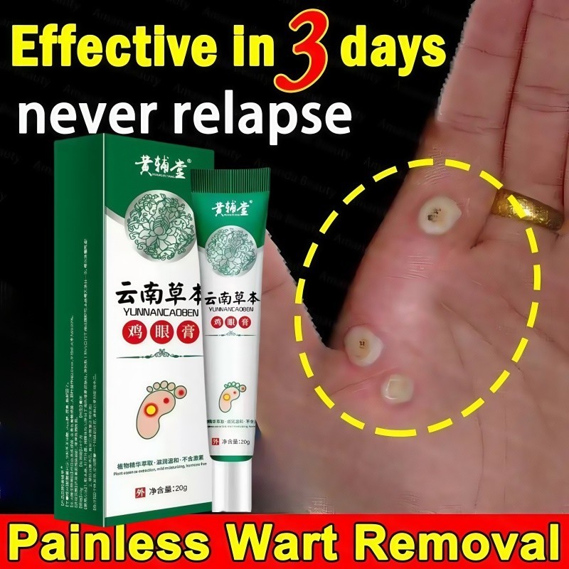 Salep Mata Ikan Ampuh Obat Mata Ikan Kaki Penghilang Mata Ikan Obat Penghilang Kutil Dan Tahi Lalat