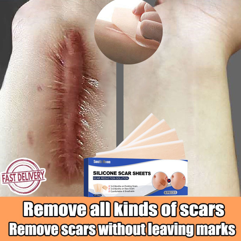 Silicone Scar Sheet plester silikon penghilang keloid bekas luka Silicon Keloid Plester Bekas Luka