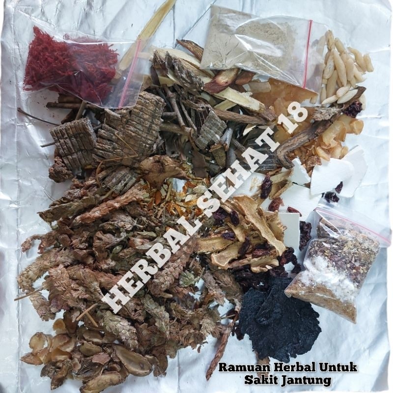 

Jamu Untuk Sakit Jantung - Herbal Jantung - Obat Jantung [PREMIUM]