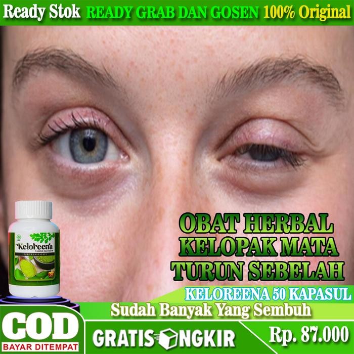 Obat Kelopak Mata Turun Sebelah, Mata Ptosis, Mata Lelah - KELOREENA (100 Kapsul)