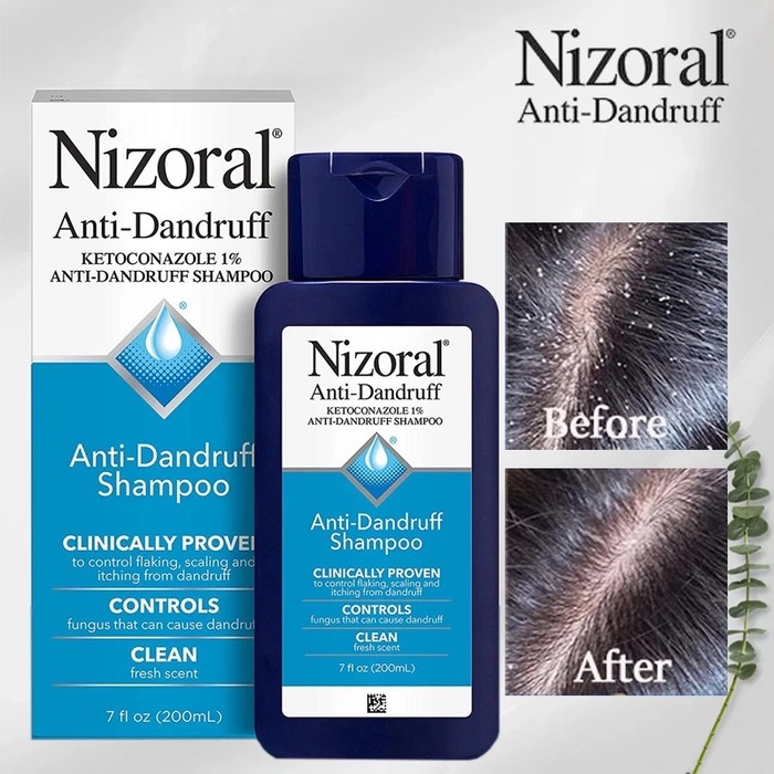 Promo Nizoral Anti Dandruff Shampoo Ketombe 1% Ketoconazole 200Ml Original Usa Ready