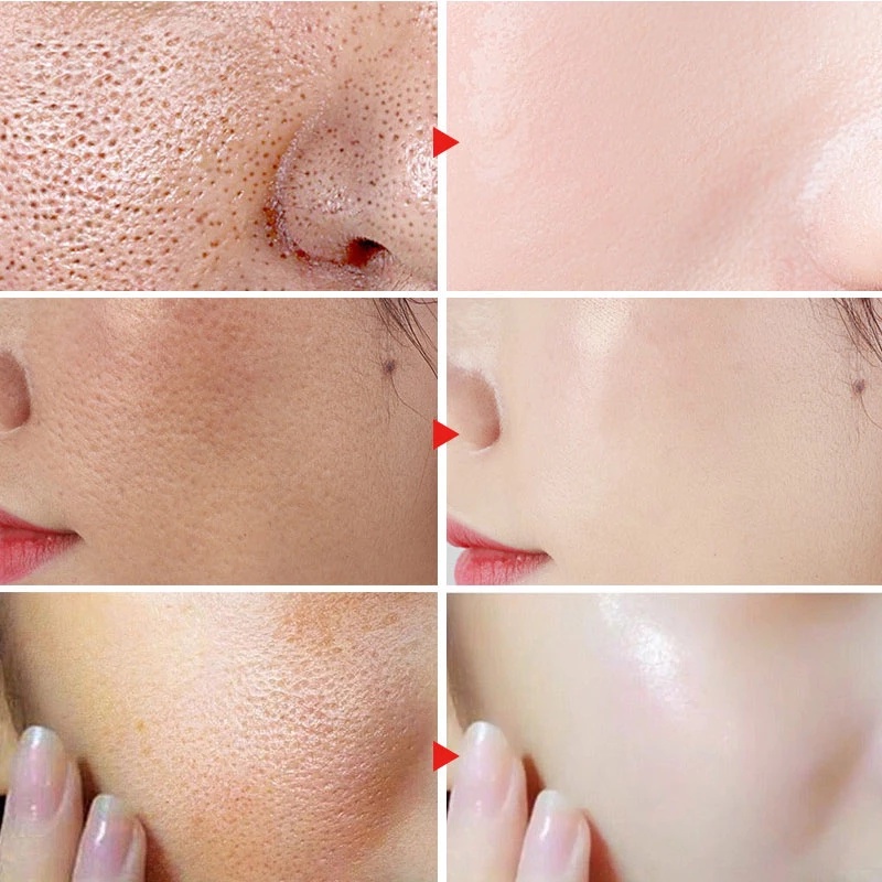 IMPORT DIMOLLAURE WHITENING FRECKLE CREAM ANTI-WRINKLE REMOVAL MELASMA FRECKLE AGE SPOT PIGMENT