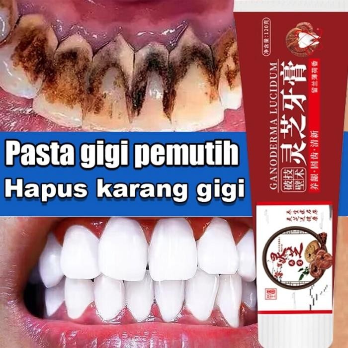 ORI 100% GANODERMA AMPUH Pasta Gigi Berlubang Penumbuh Gigi Odol pemutih gigi dan karang gigi