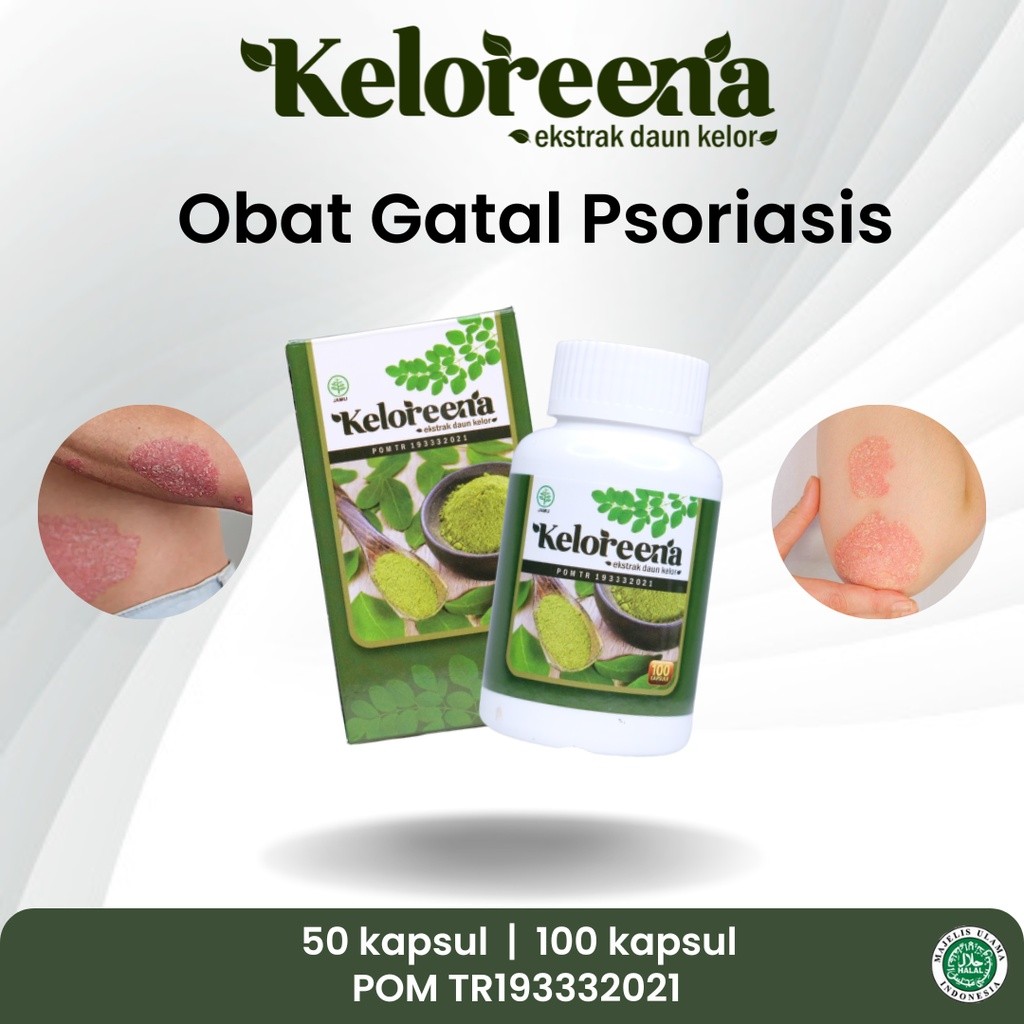 SAPNU HERBAL - OBAT PSORIASIS, PSORIASIS MENAHUN, PSORIASIS KULIT KEPALA, GATAL KULIT PSORIASIS,