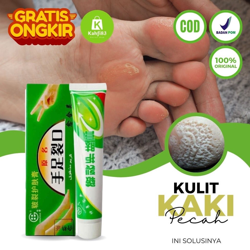 MD Obat Kaki Rayapan dan Bau - Obat Kaki Pecah Pecah dan Kering dan Kasar Penghilang Kapalan Kaki