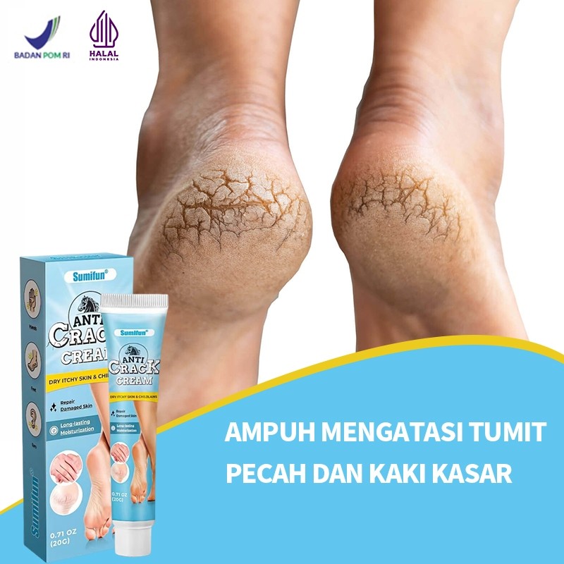 MD Krim kaki pecah dan kering salep kaki pecah dan kering ampuh perawatan kaki pecah dan kering 20g