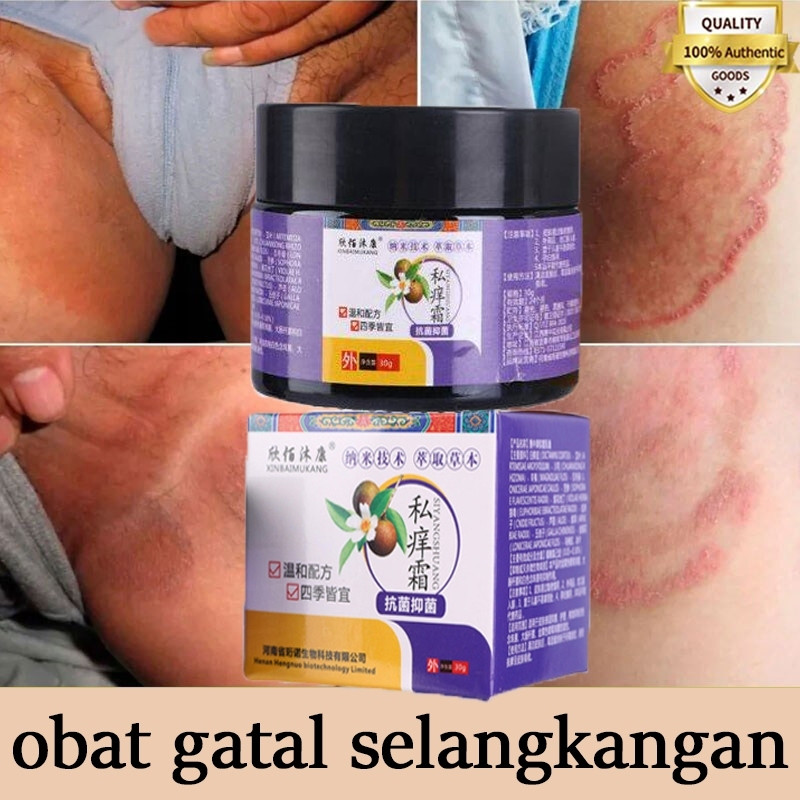 Salap gatal kulit yang ampuh obat gatal selangkangan salep gatal 30g Obat Gatal Seluruh Badan Obat