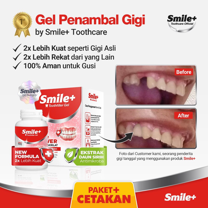 [PENAMBAL GIGI] by Smile+ Penambal Gigi Bolong Gigi Ompong Gigi Renggang Temporary Tooth