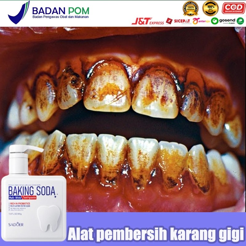 Pemutih gigi kuning Pembersih karang gigi Odol pemutih gigi dan karang gigi Pemutih gigi 300g alat