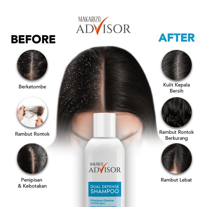 MAKARIZO ADVISOR CLINICAL SHAMPOO - DUAL DEFENSE SHAMPOO 200ML / SAMPO RAMBUT RONTOK DAN KETOMBE /