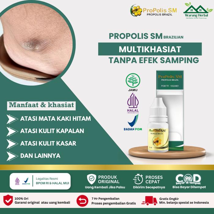 Tebaru Propolis SM Untuk Mata Kaki Hitam, Menghaluskan Kaki Kasar, Salep Kulit Kaki Pecah, Mengatasi