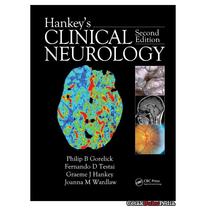 book Hankey'S Clinical Neurology Second Edition softcover