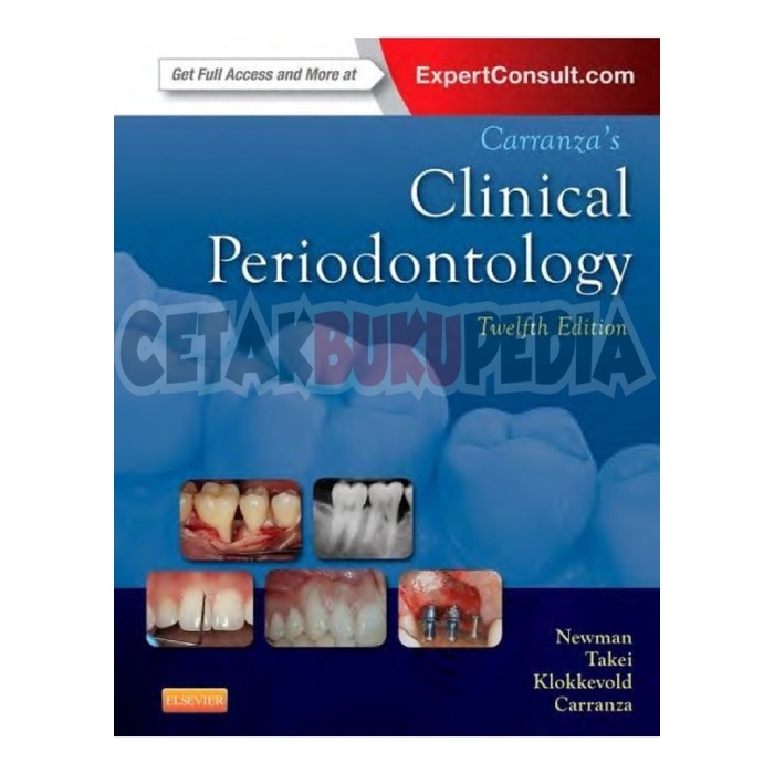 Buku English Periodontology 1 & 2 Michael G Newman CarranzaS Clinical