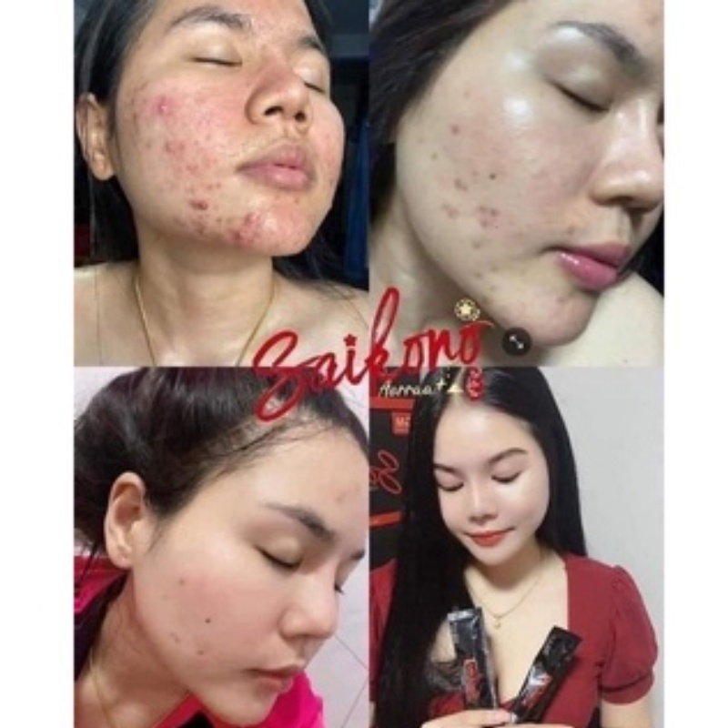 Beauty Saikono Collagen Aorraa Plus By Gm Thailand Nano Collagen Drink 15.500Mg Original / Joju