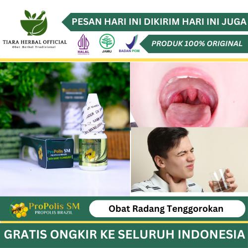 

Radang Tenggorokan, Batuk Kering, Pereda Nyeri, Sakit Tenggorokan, Tenggorokan Luka, Susah / nyeri