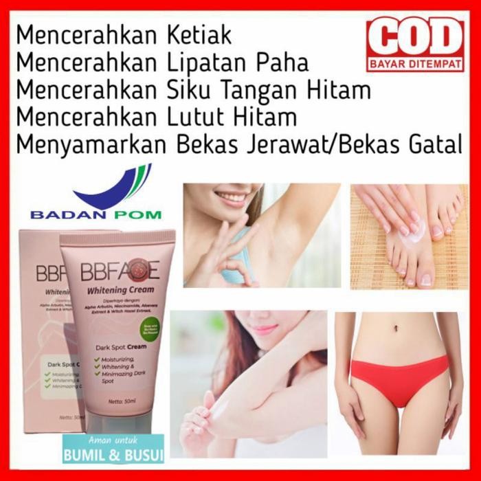 CREAM PEMUTIH SELANGKANGAN BOKONG BEKAS GATAL DAN KORENG