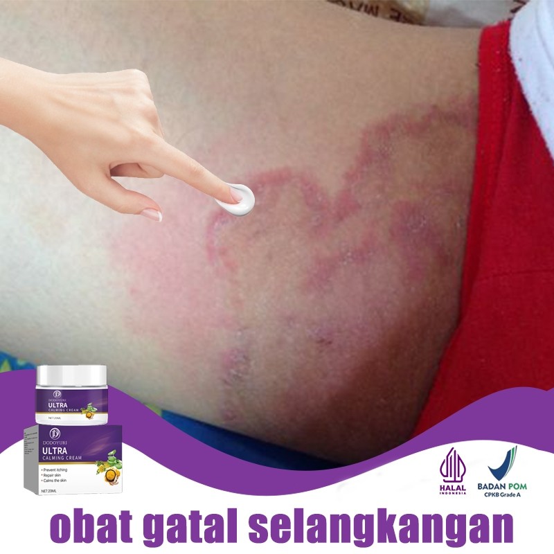Obat gatal selangkangan obat kurap salep gatal china paling ampuh salep gatal jamur selangkangan