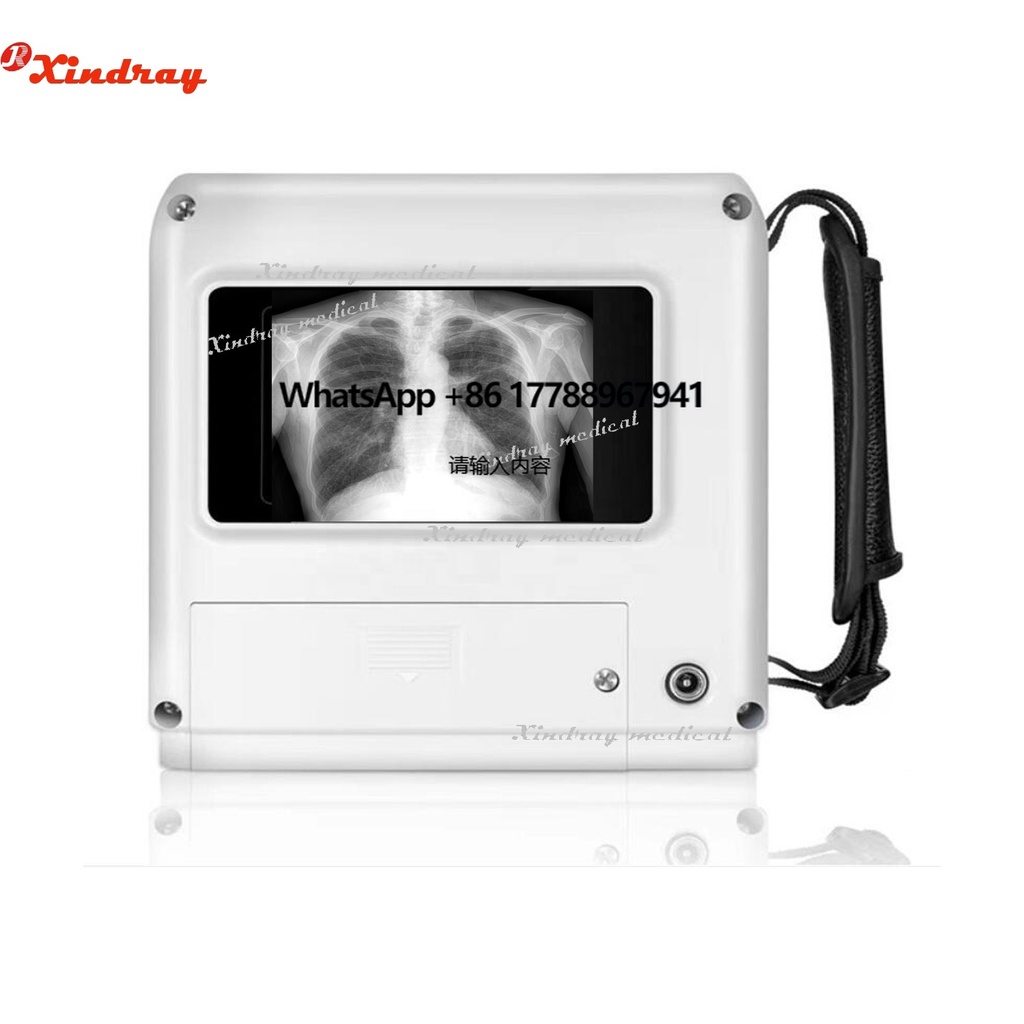 New  Medical Portable Handheld X Ray Machine Photography for X-ray Environments