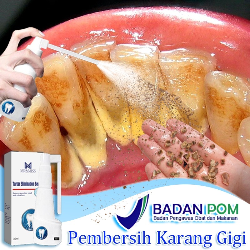 Perontok karang gigi paling ampuh alat pembersih karang gigi perontok karang gigi 30ml pembersih