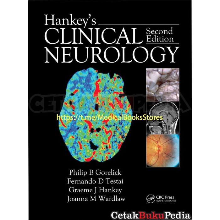 Hankey'S Clinical Neurology Philip Softcover