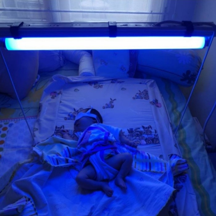 Philips TL UV Blue light 20Watt/Lampu UV baby kuning komplit set