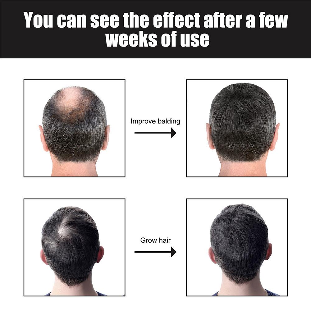 NEW 30ML FAST FOR MAN WOMEN OIL PRODUCTS ANTI-HAIR LOSS SERUM STRONG, NUTRITIOUS, MOISTURIZING
