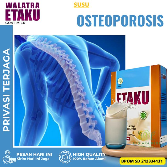 

Susu Etaku Susu Oeoporosis, Tulang Sendi Keropos, Pengapuran tulang, Pengeroposan Tulang Oeoporosis,