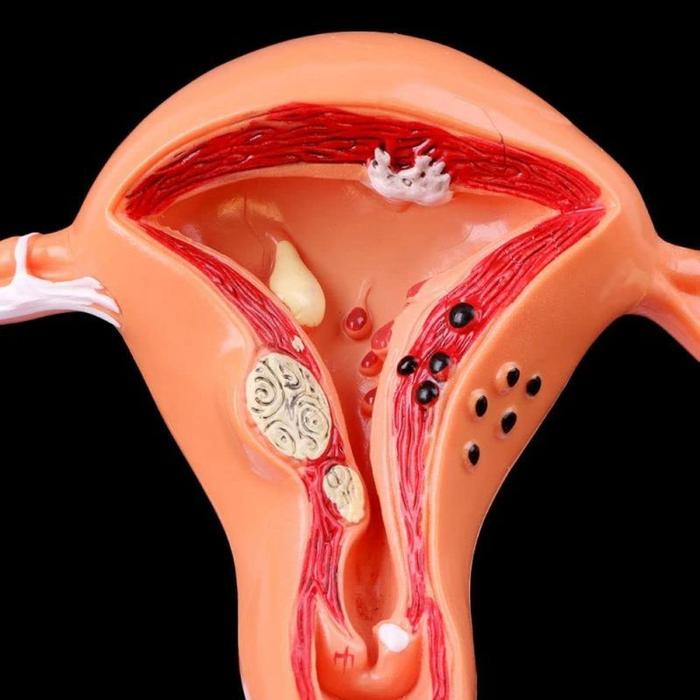 

TERLARIS Uterus Ovary Anatomical Model Anatomy Alat Peraga Anatomi Model Patologis Uterus Ovarium