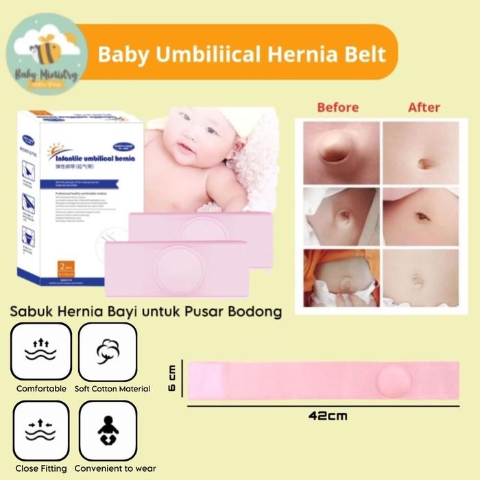 Modish- Hons Baby Umbilical Belt Hernia (Sabuk Hernia) Pusar Bodong