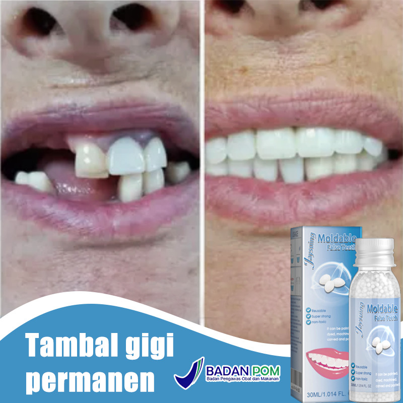 Penambal gigi berlubang tambal gigi permanen penambal gigi permanen 30g gigi palsu gigi palsu asli