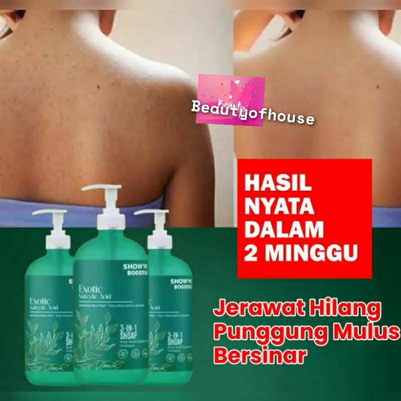 Leeva Sabun Exotic Acne 250ml - sabun Mandi kulit sensitif, mrngatasi jerawat dan panu