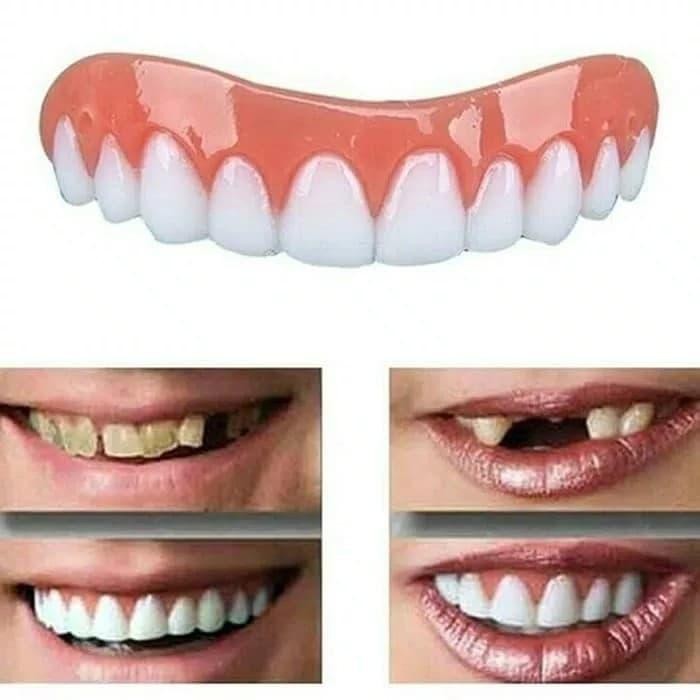 PERFECT SMILE GIGI PALSU INSTANT n SENYUM SEMPURNA