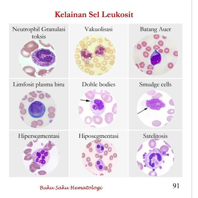 Buku Saku Hematologi