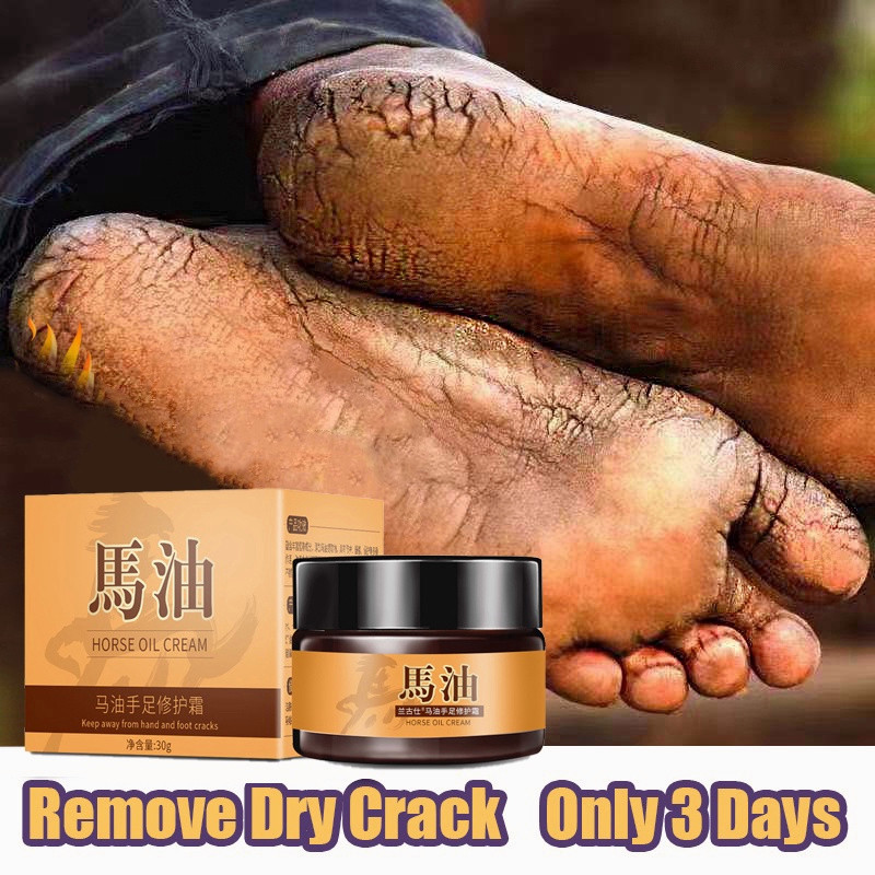 MD kaki obat kaki pecah dan kering krim obat kaki pecah pecah alat kaki pecah pecah cream kaki pecah