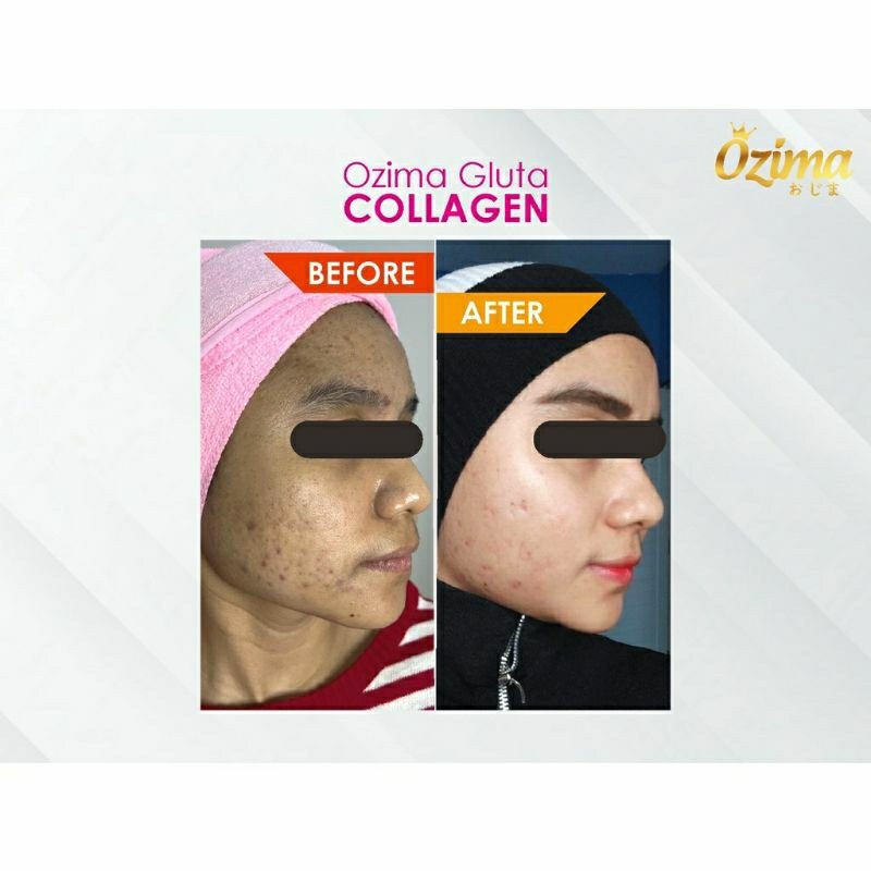 Ozima Drink Minuman Pencerah Kulit