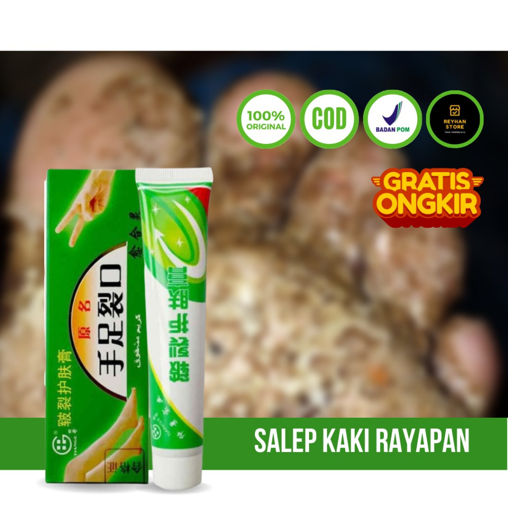 MD Obat Kaki Rayapan Dan Bau - Salep Cina Obat Gatal Krim Pengelupas Kulit Mati Kaki Pembersih Kulit