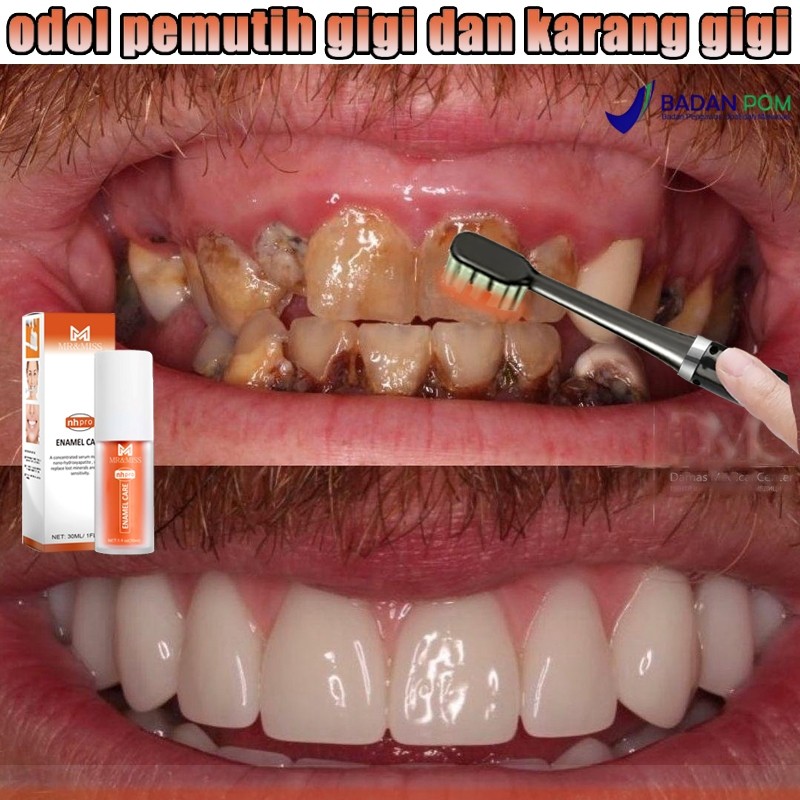 Odol pemutih gigi dan karang gigi perontok karang gigi Pasta gigi pemutih perontok karang gigi
