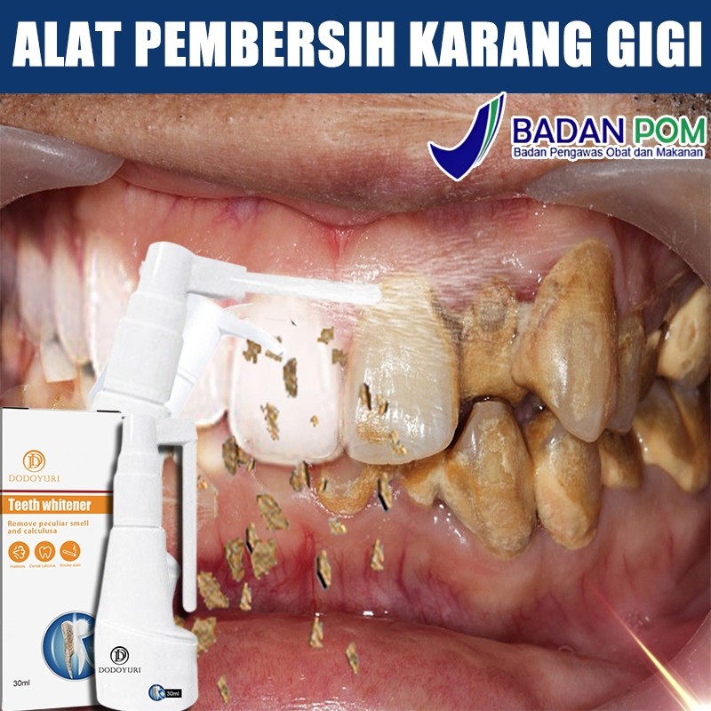 Penghilang karang gigi membandel Pembersih karang gigi pemutih gigi alat pembersih karang gigi 30ml